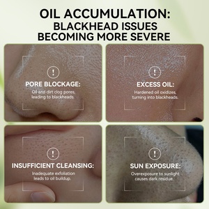 Lanbena than tre loại bỏ mụn đầu đen tất cả các da Stype mặt nạ lỗ chân lông Dải sâu sạch hỗ trợ OEM ODM - Product Image 3