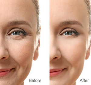 BAWEI Anti envejecimiento Anti arrugas cara blanca crema máscara péptido de colágeno de la reparación de la piel máscara vitamin - Product Image 6