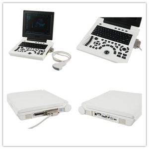 Vente chaude grande qualité 2D noir et blanc basique OB Gyn vasculaire 12 pouces ordinateur portable Portable ultra équipement <span class=keywords><strong>sonore</strong></span> - Product Image 5