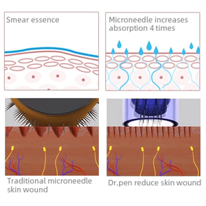 Cartuchos de Repuesto para Dr.<span class=keywords><strong>Pen</strong></span> <span class=keywords><strong>Ultima</strong></span> M8, Agujas Desechables para Microneedling, Cartuchos de Agujas Estériles para Dermapen Dr. <span class=keywords><strong>Pen</strong></span> M8 - Product Image 3