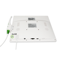 Système de caméra intra-orale haute résolution avec objectif macro pour usage dentaire et moniteur PC