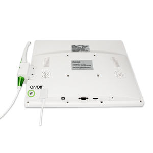 Système de caméra intra-orale haute résolution avec objectif <span class=keywords><strong>macro</strong></span> pour usage <span class=keywords><strong>dentaire</strong></span> et moniteur PC - Product Image 2