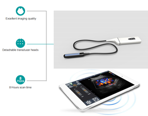 Ecógrafo Veterinario DMSU24, Precio de Fábrica, Nuevo, Sonda Inalámbrica Portátil, Conexión Wi-Fi Disponible - Product Image 2