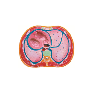 การผ่าตัดทรวงอกรุ่น310x210x40 (มม.) SMD074 - Product Image 1