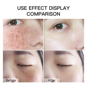 Biosphere Customized Niacinamide Cleansing <b>Gel</b> Cleansing <b>Makeup</b> <b>Removal</b> Paraben Free Hydrating Vegan Facial Cleanser - Product Image 3