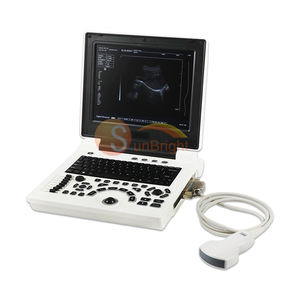 Vente chaude grande qualité 2D noir et blanc basique OB Gyn vasculaire 12 pouces ordinateur portable Portable ultra équipement <span class=keywords><strong>sonore</strong></span> - Product Image 1