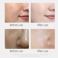 Crème visage éclaircissante et anti-taches, légère et hydratante, non grasse, contenant de la niacinamide, 30g