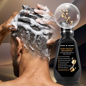 Shampooing Chinois <span class=keywords><strong>Anti</strong></span>-<span class=keywords><strong>Chute</strong></span> en Gros au Gingembre et Biotine pour Nettoyage en Profondeur des Cheveux, Renforcement des Racines, Croissance Capillaire Bio pour Hommes et Femmes - Product Image 4