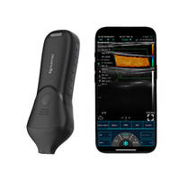 Ультразвуковой линейный датчик KONTED C10MB Pro с высокочастотным режимом, USB и Wi-Fi
