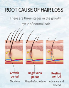 Loción tónica orgánica China para el cabello, suero de esencia de aceite de romero, laca nutritiva para el cabello que ayuda a crecer el cabello Calvo rápidamente - Product Image 5