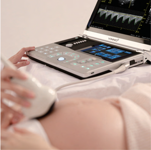 Vinno 5 Clinical <strong>Portable</strong> Color Ultrasound System High Frequency Diagnostic <strong>Scanner</strong> for Hospital &amp; Clinic - Product Image 5