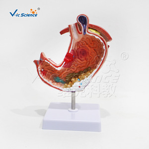 Modèle anatomique gastrique pathologique de grande taille ; outil pédagogique pour l'étude des structures pathologiques de l'estomac humain. - Product Image 3