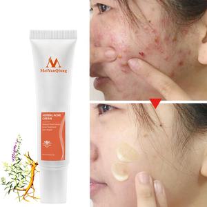 Meiyanqiong <span class=keywords><strong>Crema</strong></span> y loción facial a base de hierbas de alta calidad, antiacné y eliminación de cicatrices para pieles grasas con manchas de acné - Product Image 3