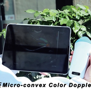 Sonde microconvexe portable WiFi pour échographie vétérinaire avec 23h d'autonomie - Multi-modes pour urgences abdominales CU15 - Product Image 2