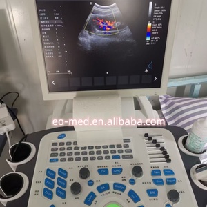 เครื่องอัลตราซาวนด์เคลื่อนที่อเนกประสงค์แบบพกพา รุ่น TC29 พร้อมระบบสีดอปเปลอร์ สำหรับการวินิจฉัยโรค - Product Image 4