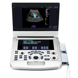 Escáner de Ultrasonido Doppler Portátil Estilo Laptop con Imágenes a Color, Mediciones Automáticas, 256 Cuadros, Cine Loop para Diagnóstico General - Product Image 3