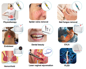 Endo Face Lift Dispositivo de láser óptico de Cirugía Dental portátil 980nm + 1470nm Diodo Láser Liposucción Reutilizable Fibra óptica médica - Product Image 6