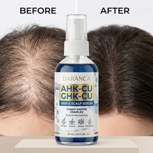 Siero Spray per la Crescita dei Capelli con Etichetta Privata, 5% Ahkcu Ghkcu, Peptidi di Rame Blu Ahk-cu e Ghk-cu, Cura dei Capelli allo Zenzero - Product Image 1