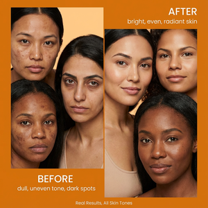 <span class=keywords><strong>Savon</strong></span> artisanal au curcuma et à l'acide kojique, blanchissant, naturel, biologique, en gros, <span class=keywords><strong>savon</strong></span> exfoliant au curcuma, <span class=keywords><strong>savon</strong></span> éclaircissant pour le visage - Product Image 4