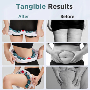 Herramienta Musical de Masaje Anticelulítico, Masajeador de Drenaje Linfático, Rodillo Muscular para Eliminar la <span class=keywords><strong>Celulitis</strong></span> <span class=keywords><strong>y</strong></span> la Flacidez Profunda de la Piel para Hombres <span class=keywords><strong>y</strong></span> Mujeres - Product Image 3