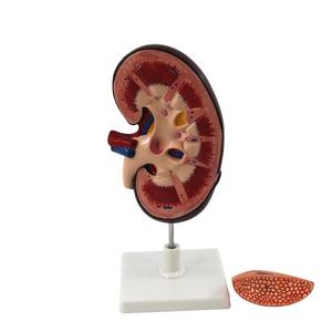 Modelo de riñón humano con glándula adrenal, material de buena calidad, para enseñanza anatómica, tamaño real - Product Image 6
