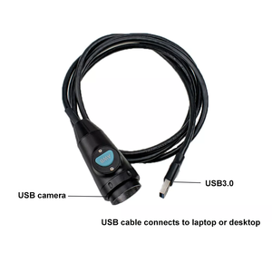 TUYOU fabrika USB Full Hd 1080p tıbbi Video endoskop kamera Ent kulak endoskopi - Product Image 4