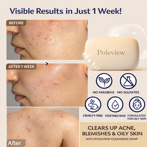 Nuovo Sapone da Bagno Senza Parabeni, Senza Test su Animali, con Zolfo e Aloe Vera per Pelle Grassa - Product Image 4