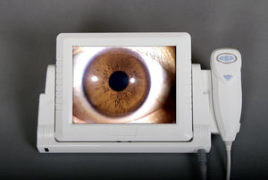 MC-A01 त्वचा और निष्पक्ष विश्लेषक/सरल ऑपरेशन वीडियो <span class=keywords><strong>dermatoscope</strong></span> चीन - Product Image 5