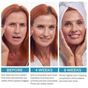 <span class=keywords><strong>Crema</strong></span> <span class=keywords><strong>Viso</strong></span> Nutriente Idratante Profonda con Collagene, Retinolo e Acido Ialuronico 5% a Marchio Privato per la Cura del <span class=keywords><strong>Viso</strong></span> - Product Image 4