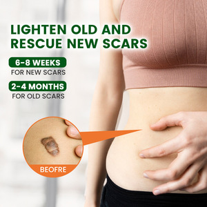 Bálsamo Reparador de Quemaduras y Anti-Infecciones para Piel Quemada, Ungüento para Quemaduras y Escaldaduras, Promueve la Curación de la Piel - Product Image 2