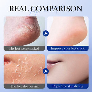 Crème Hydratante et Exfoliante SADOER Pieds à l'Avocat et <span class=keywords><strong>Vaseline</strong></span>, Stick de Soin OEM pour Talons Fissurés - Product Image 3