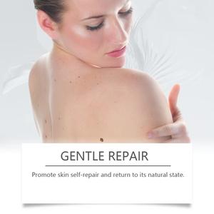 Stylo d'élimination des verrues à double extrémité pour éliminer les boutons plats de peau et les épines de chair Ensemble de granules de viande <span class=keywords><strong>plantaire</strong></span> plate - Product Image 3