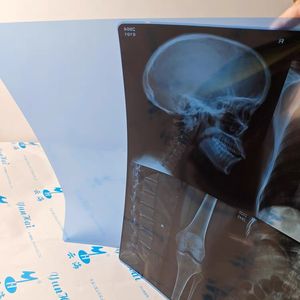 Film medico del Laser del DR CR di CT asciutta medica del Film X Ray del Laser blu 210 micron Film medico trasparente blu del Laser di Ziguang - Product Image 1