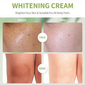 <span class=keywords><strong>Precio</strong></span> de fábrica, crema blanqueadora íntima iluminadora para el cuerpo, cara, axila, <span class=keywords><strong>rodilla</strong></span>, punto de glúteos, decoloración de la piel oscura - Product Image 2