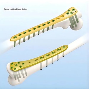 Y-Shaped Titanium Micro Locking Plates Maxillofacial <strong>Implants</strong> &amp; <strong>Interventional</strong> <strong>Materials</strong> with Locking Plate - Product Image 3
