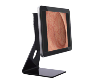 लचीला Gastroscope प्रणाली वीडियो पशु चिकित्सा एंडोस्कोप - Product Image 2