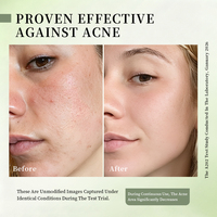 Fruitzuur Peelingoplossing Vloeibare acnebehandeling Gezichtsserum Essentie Whitening Huidverzorgingsproducten Gezicht exfoliërend