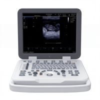 Alat USG Veteriner SONOIMAGE N20 CE dengan Visualitas Jernih dan Instrumen Tahan Lama untuk Diagnostik Peternakan di Pedesaan
