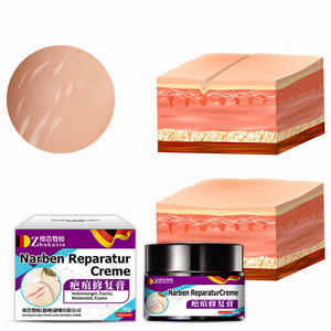 ครีมกำจัดรอยแผลเป็น-รอยแผลเป็นตามธรรมชาติและครีมบำรุงแผลสำหรับการใช้งานภายนอกที่กำหนดเอง - Product Image 3