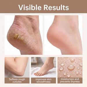 High Quality Hot Sell 15g Organic Bee Venom <strong>Wart</strong> Corn &amp; Callus <strong>Remover</strong> Smooth Skin <strong>Cream</strong> Gentle Moisturizing Body Care <strong>Cream</strong> - Product Image 6