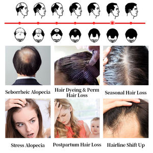 Tratamiento profesional para el cabello para hombres y <span class=keywords><strong>mujeres</strong></span>, suero para la pérdida y el crecimiento del cabello con Spray de jengibre, extrafuerte, uso diario - Product Image 3