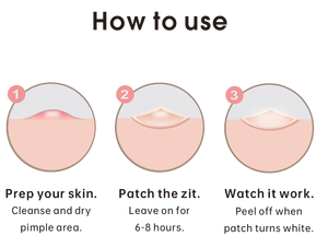 Parches de espinillas hidrocoloides personalizados al por mayor con marcas de viruela con patrón de estrella cósmica luminosa - Product Image 3