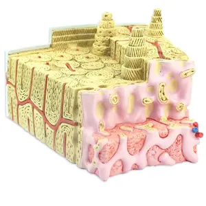 Модель для обучения анатомии костной ткани остеопороза, модель для кости бедра, поясницы, межпозвоночного диска