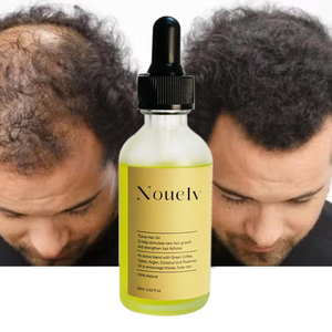 OEM Tùy Chỉnh 60Ml Hữu Cơ Dầu Thầu Dầu 100% Hữu Cơ Tự Nhiên Sản Phẩm Chăm Sóc Tóc Làm Mới Các Loại Thảo Mộc Da Đầu Nuôi Dưỡng Cho Sự Tăng Trưởng Tóc - Product Image 2