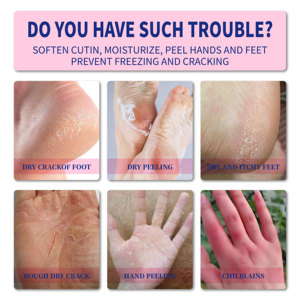 Unguento <span class=keywords><strong>per</strong></span> Mani e <span class=keywords><strong>Piedi</strong></span> Screpolati, Unguento <span class=keywords><strong>per</strong></span> Scottature, Unguento alle Erbe di Cartamo <span class=keywords><strong>per</strong></span> Mani e <span class=keywords><strong>Piedi</strong></span> Screpolati - Product Image 2