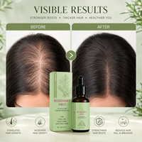 Huile Capillaire Naturelle Végétalienne Biologique Anti-Chute Romarin Menthe Traitement Repousse Cheveux Romarin Oignon Biotine Kératine Haute Croissance