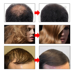 Private Label Ginger Natural Organic Hyaluronic Acid Nourishing Fluffy Anti Loss Regrowth Biotin Fast Hair Growth Oil Serum - Product Image 4