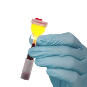 Tubo de Ensayo Centrífugo Tipo Y para Restauración Capilar Ortopédica, Sin Aditivos - Product Image 5