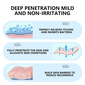 Crema hidratante antipruriginosa para la piel, crema herbal para <span class=keywords><strong>hongos</strong></span> y psoriasis, ungüento para alergias cutáneas - Product Image 4