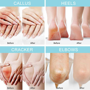 Vitamina 40% natural <span class=keywords><strong>Urea</strong></span> menta colágeno árbol de té olor de pie removedor de piel muerta nutritiva cuidado de la piel de manos y pies <span class=keywords><strong>Crema</strong></span> para pies - Product Image 6
